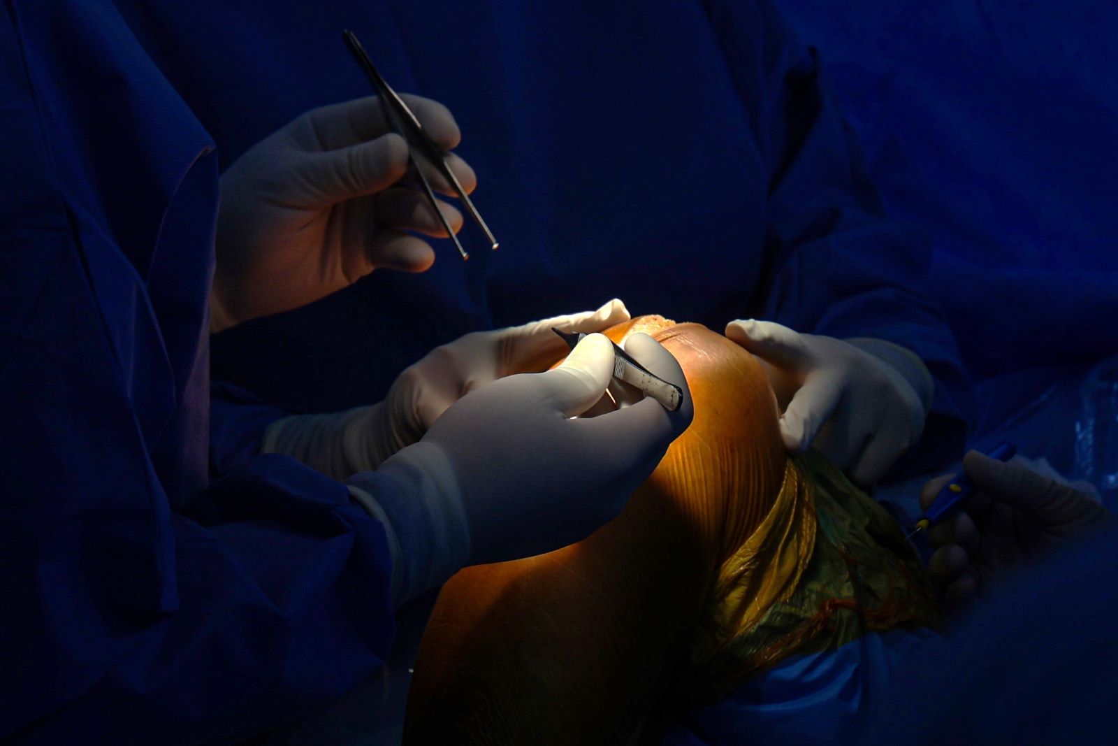 Hospital São José de Maravilha eleva patamar assistencial com habilitação em Alta Complexidade